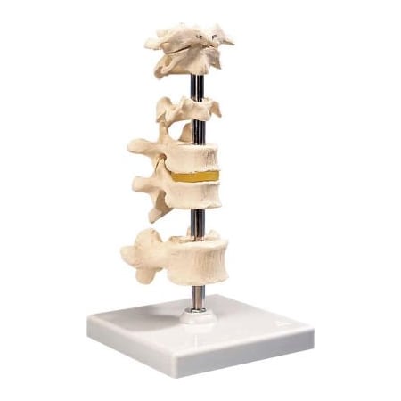 Fabrication Enterprises 3B Anatomical Model - 6 Mounted Vertebrae with Removable Stand 983935